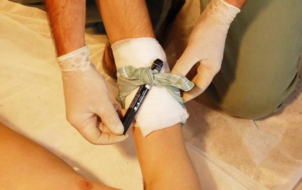 Первая помощь при острой кровопотере и травматическом шоке
Первая помощь при острой кровопотере и травматическом шоке