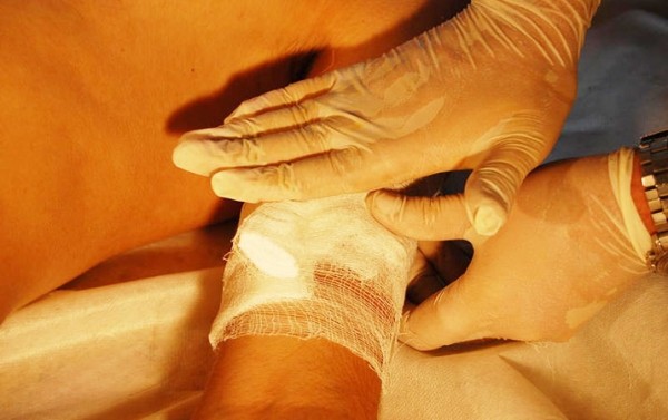 Первая помощь при острой кровопотере и травматическом шоке
Первая помощь при острой кровопотере и травматическом шоке