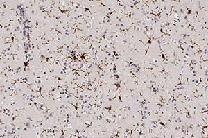 Патоморфологические изменения головного мозга при COVID-19
Патоморфологические изменения головного мозга при COVID-19