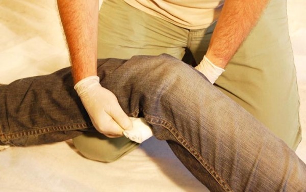 Первая помощь при острой кровопотере и травматическом шоке
Первая помощь при острой кровопотере и травматическом шоке