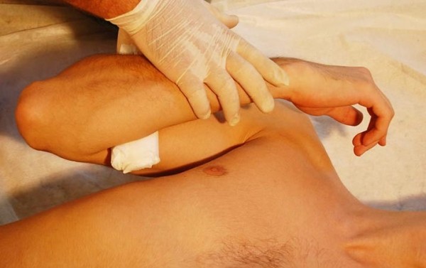 Первая помощь при острой кровопотере и травматическом шоке
Первая помощь при острой кровопотере и травматическом шоке