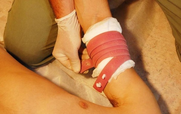 Первая помощь при острой кровопотере и травматическом шоке
Первая помощь при острой кровопотере и травматическом шоке