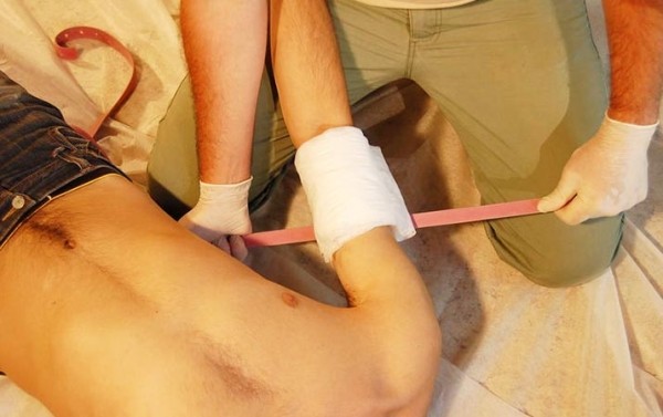 Первая помощь при острой кровопотере и травматическом шоке
Первая помощь при острой кровопотере и травматическом шоке