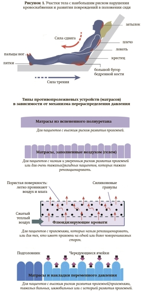 Профилактика и лечение пролежней
Профилактика и лечение пролежней