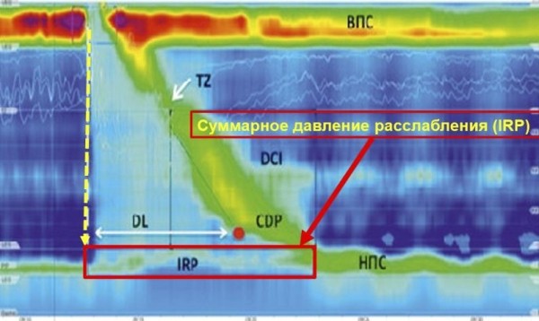
			Манометрия пищевода высокого разрешения		