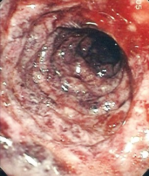 Острая гастродуоденальная боль. Часть 2
Острая гастродуоденальная боль. Часть 2