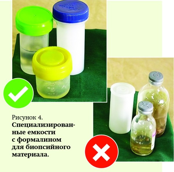 Патогистологическое сопровождение при диагностике заболеваний
Патогистологическое сопровождение при диагностике заболеваний