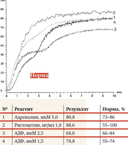 Агрегатометрия: нюансы прочтения анализов
Агрегатометрия: нюансы прочтения анализов