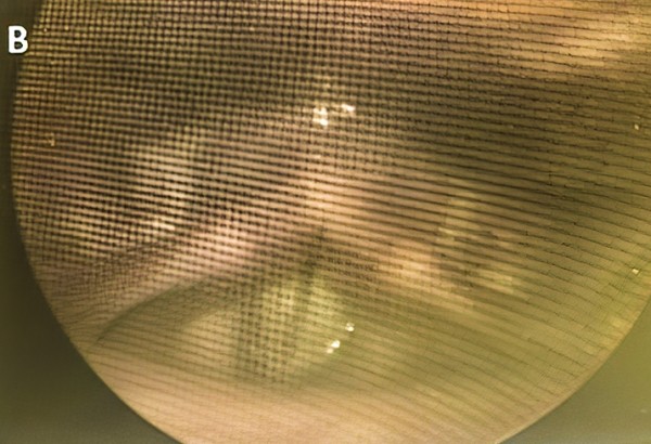 
        Нарушения голоса у пациентов с СOVID-19			    