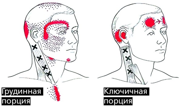 
        «Замороженные в мышцах чувства»: как связаны тревога, депрессия и боль?			
        
        