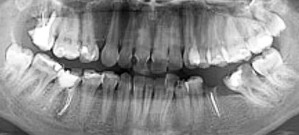 
        Надо ли удалять «восьмерки»? Как принять обоснованное решение                    
