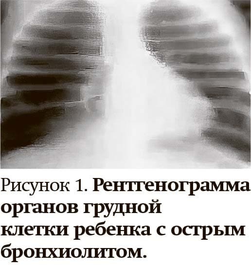 Кашель у детей: особенности дифференциальной диагностики
Кашель у детей: особенности дифференциальной диагностики