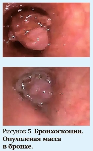 Кашель у детей: особенности дифференциальной диагностики
Кашель у детей: особенности дифференциальной диагностики