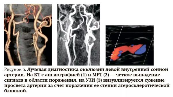 Лучевая диагностика при кровотечениях и тромбозах: плюсы и минусы разных методов
Лучевая диагностика при кровотечениях и тромбозах: плюсы и минусы разных методов