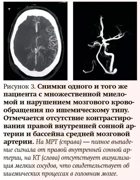 Лучевая диагностика при кровотечениях и тромбозах: плюсы и минусы разных методов
Лучевая диагностика при кровотечениях и тромбозах: плюсы и минусы разных методов