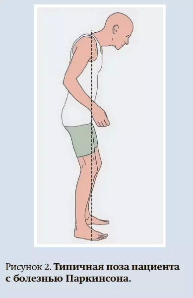 Ранние стадии болезни Паркинсона: диагностика и лечение + аудио
Ранние стадии болезни Паркинсона: диагностика и лечение + аудио