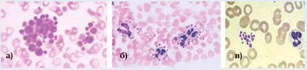 
        Первичный гемостаз и методы его оценки: оптическая и импедансная агрегатометрия                     