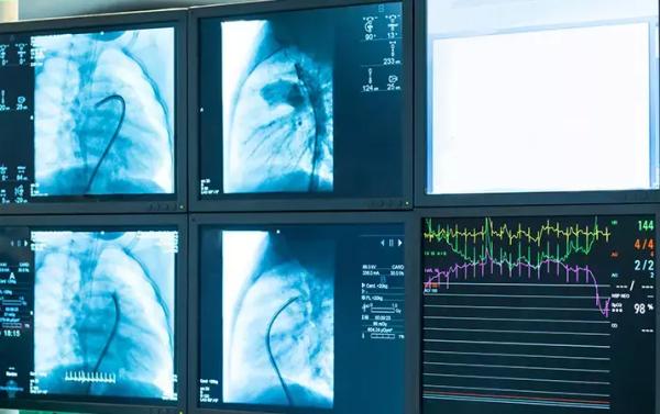 
        Безопасность интервенционных вмешательств: современные принципы навигации                    