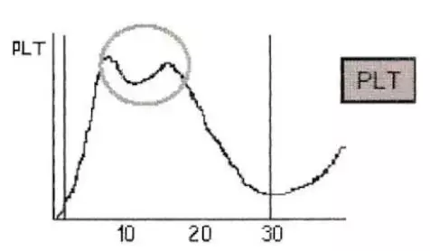 Первичный гемостаз и методы его оценки: оптическая и импедансная агрегатометрия
Первичный гемостаз и методы его оценки: оптическая и импедансная агрегатометрия